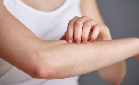 impact skin impact skin