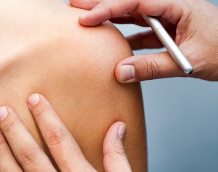BIODERMA, skin expert innovating for skin weakened
