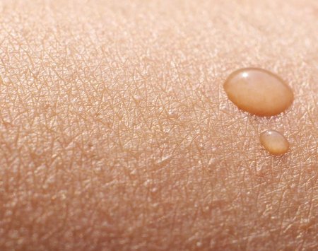 What happens to skin 